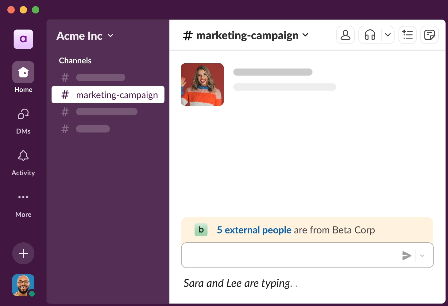 Slack